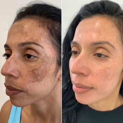Turmeric + Kojic Acid Brightening Cleanser