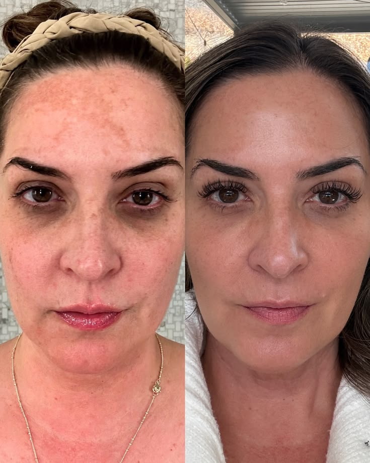 Turmeric + Kojic Acid Brightening Cleanser
