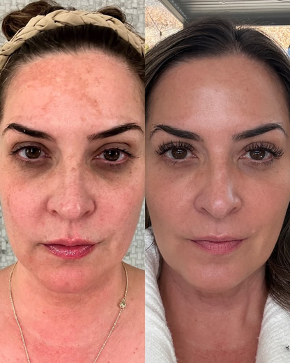 Turmeric + Kojic Acid Brightening Cleanser