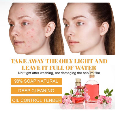 Turmeric + Kojic Acid Brightening Cleanser