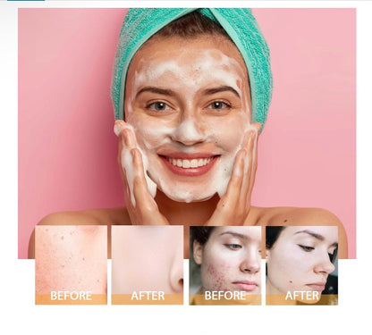 Turmeric + Kojic Acid Brightening Cleanser