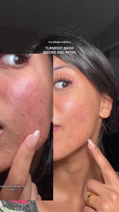 Turmeric + Kojic Acid Brightening Cleanser