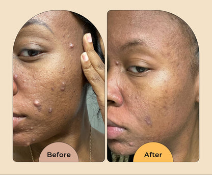 Turmeric + Kojic Acid Brightening Cleanser