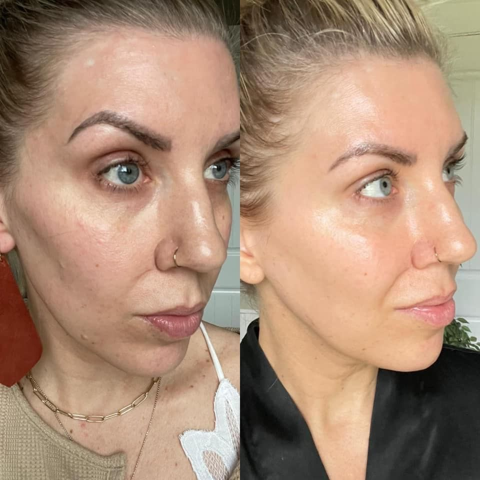 Turmeric + Kojic Acid Brightening Cleanser