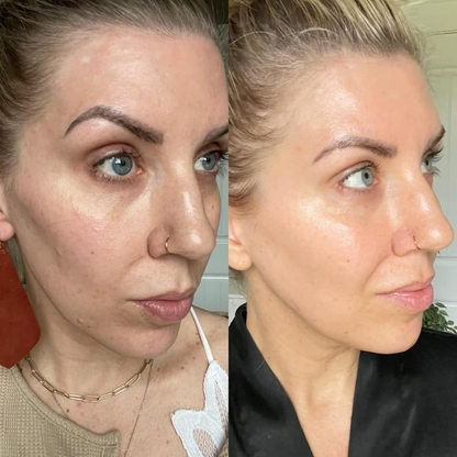 Turmeric + Kojic Acid Brightening Cleanser